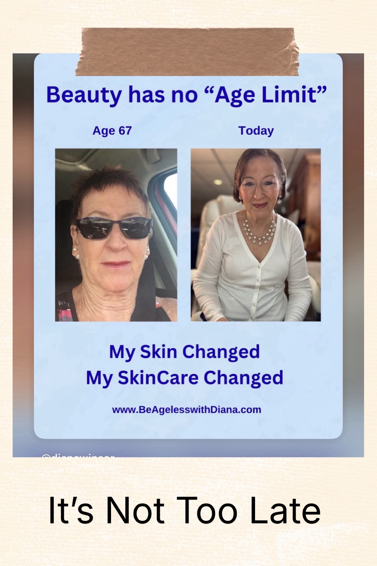 Fine Lines & Wrinkles: Understanding Your Skin and Aging with Confidence